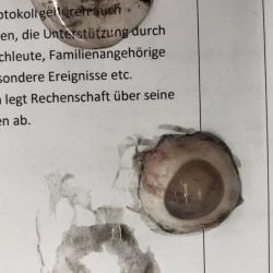 Hornhaut und Glaskorper